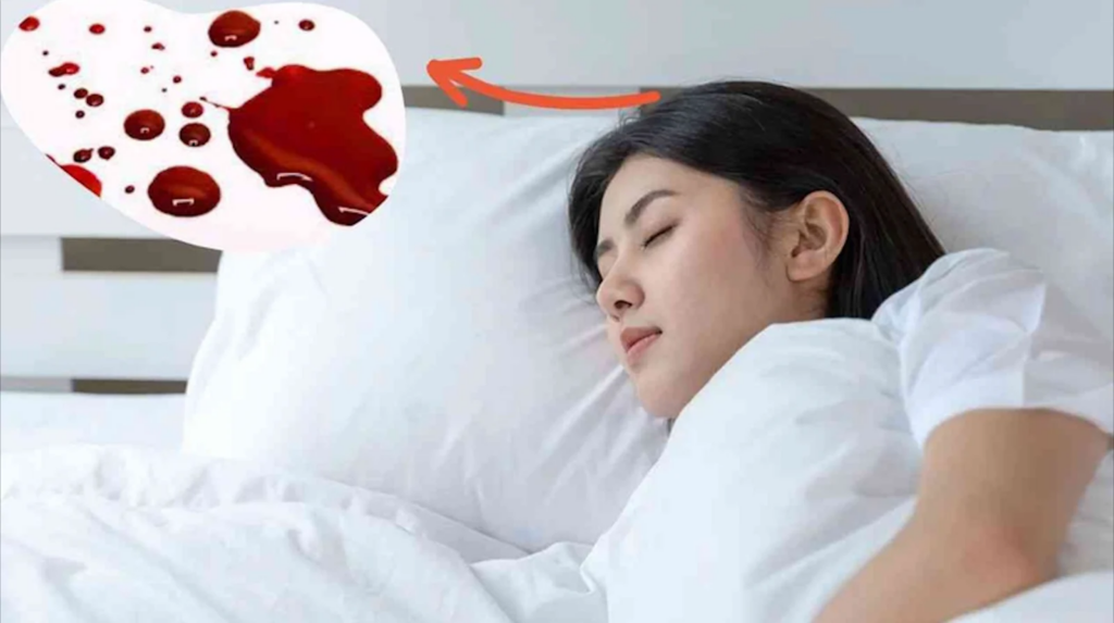 Nằm mơ thấy máu là hiện tượng không hiếm gặp