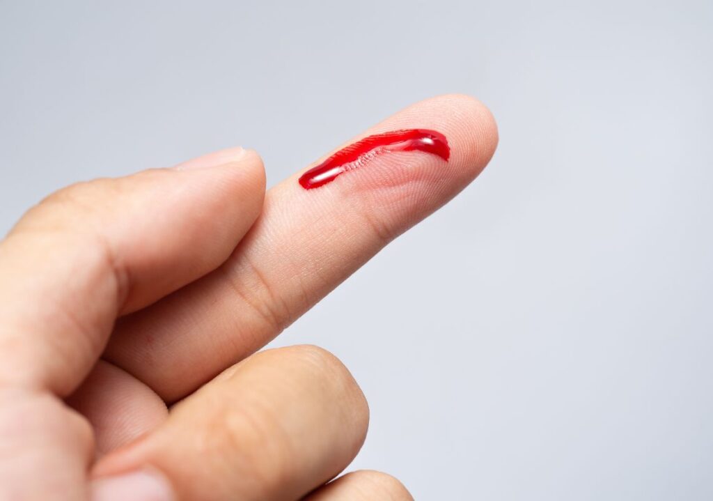 Nằm mơ thấy máu ẩn chứa điềm báo sắp tới